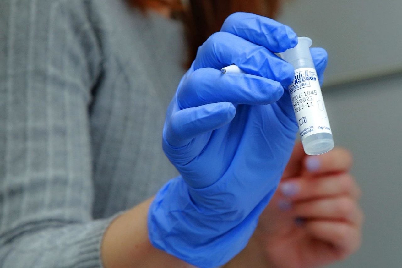 Узнай ВИЧ-статус: где сдать экспресс-тест до конца марта в Новосибирске