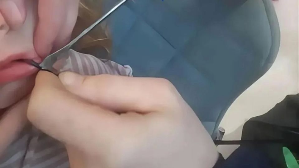 Язык застрял в спицах зонта