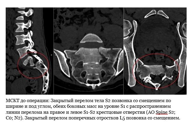 Новосибирские врачи спасли девушку, разбившуюся на квадроцикле Новосибирские врачи спасли девушку, разбившуюся на квадроцикле