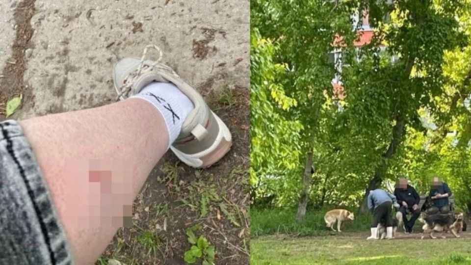 Стая собак набросилась на девушку