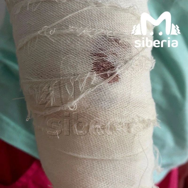 Овчарка напала на женщину в Новосибирске Овчарка напала на женщину в Новосибирске