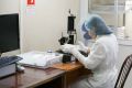 В Новосибирске зафиксирован рост заболеваемости энтеровирусной инфекцией
